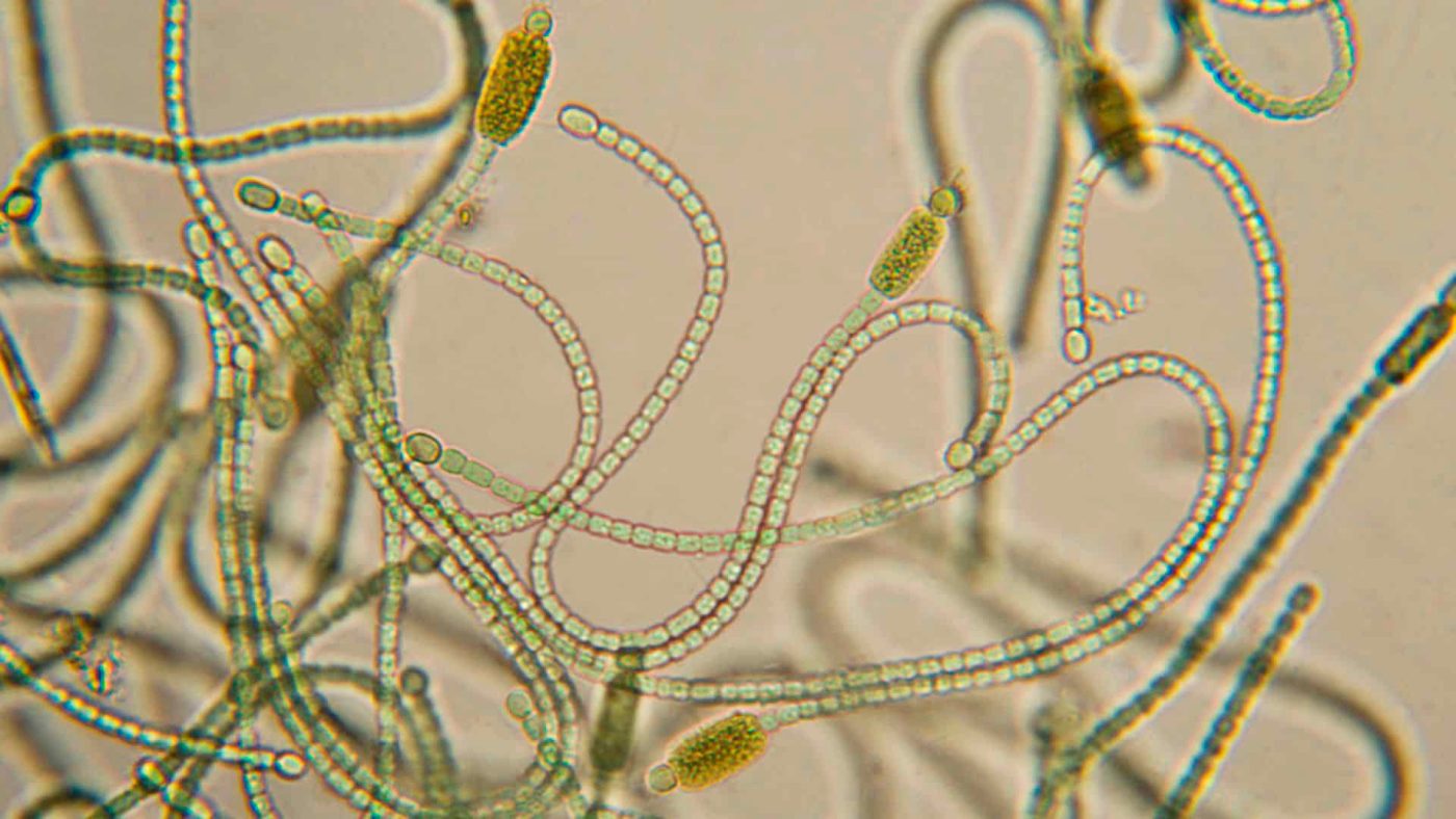 post-algas-en-balsas-de-riego-microcistinas-imcur-www.imcur.com